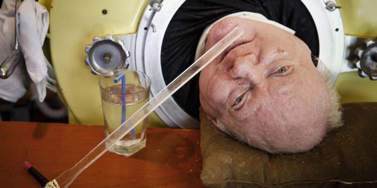 Paul Alexander, who used an iron lung for decades after contracting polio as a child, dies at 78