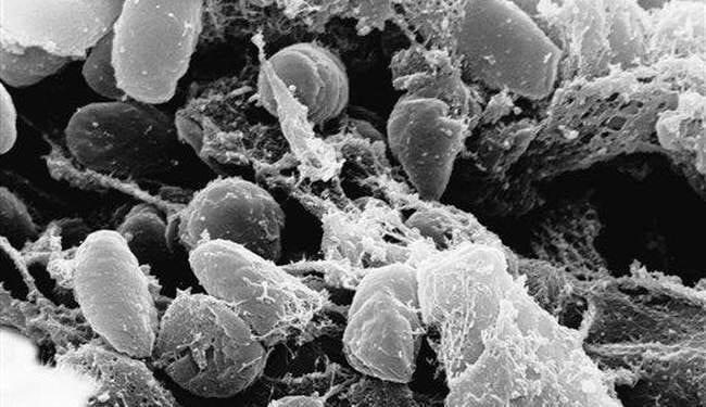 Super. New Mexico Man Dies of Black Plague – HotAir