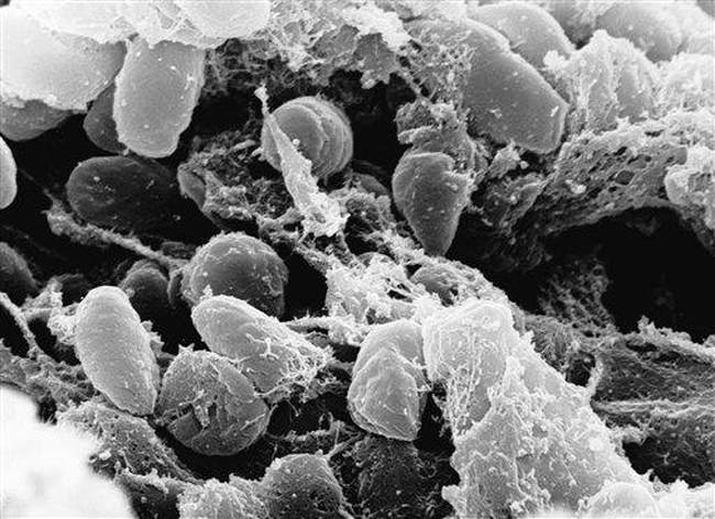 Super. New Mexico Man Dies of Black Plague – HotAir