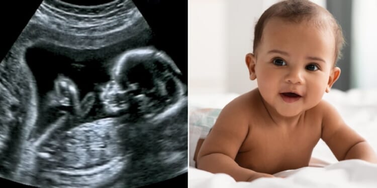 An ultrasound image of a baby in the wormb, left; a smiling baby, right.