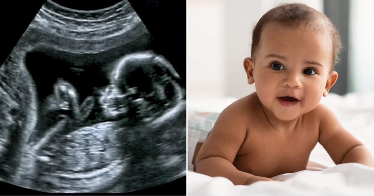 An ultrasound image of a baby in the wormb, left; a smiling baby, right.