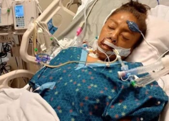 Janelle Scott was attacked by a pitbull and lost all four of her legs on Sept. 9, 2025, in Okmulgee, Oklahoma.