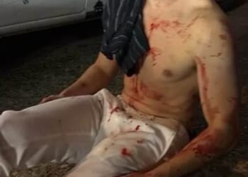 Teens Who Attacked Edward 'Big Balls' Coristine Get Rehabilitated – HotAir