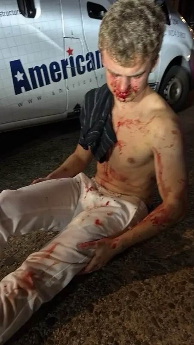 Teens Who Attacked Edward 'Big Balls' Coristine Get Rehabilitated – HotAir