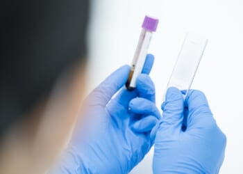 Sperm donor who carried cancer-causing mutation fathered nearly 200 kids