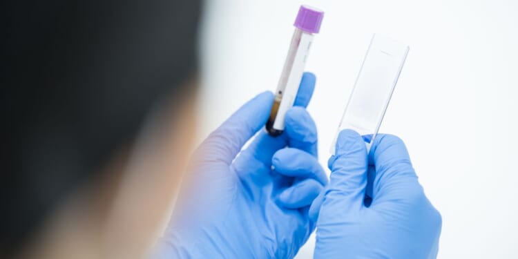 Sperm donor who carried cancer-causing mutation fathered nearly 200 kids