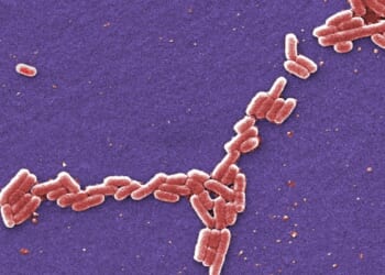 FDA probes multistate E. coli outbreak tied to RAW FARM raw cheddar cheese