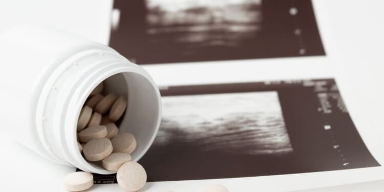 Abortion pills are depicted in front of an ultrasound.