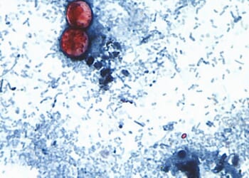 Foodborne illnesses at restaurant chains are rare but can sicken customers