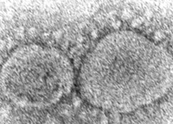 HHS adopts limit to ‘dangerous’ virus research after executive order reining in federal support