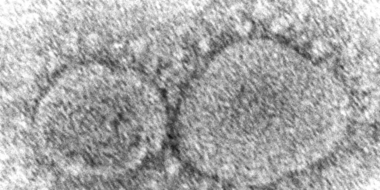 HHS adopts limit to ‘dangerous’ virus research after executive order reining in federal support