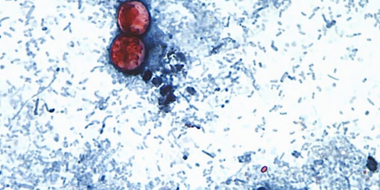 Federal infectious disease surveillance is hampered by split oversight: Report