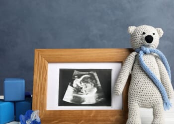 A composition with a child's ultrasound photo and toys.