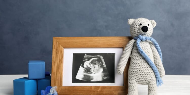 A composition with a child's ultrasound photo and toys.
