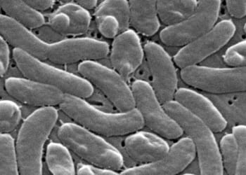 Flesh-eating bacteria kills 5 in Louisiana as cases outpace 10-year average