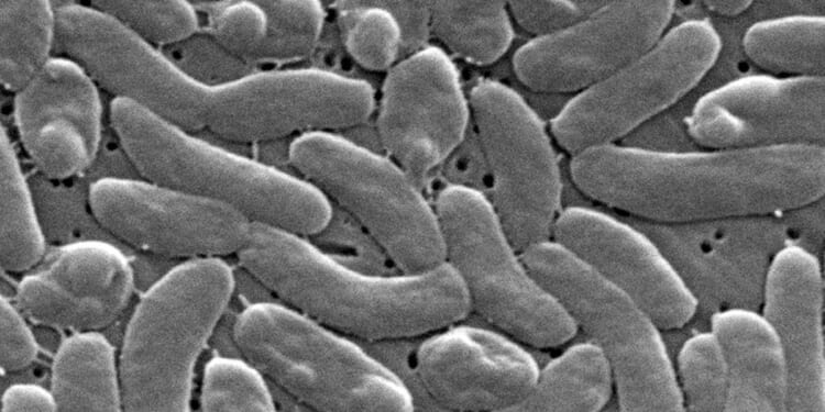 Flesh-eating bacteria kills 5 in Louisiana as cases outpace 10-year average