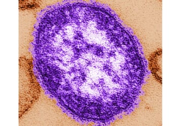 Maryland declares measles outbreak in three counties