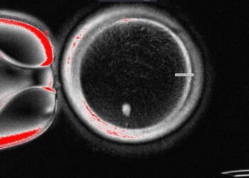 Oregon researchers turn human skin cells into eggs -- but not yet usable ones