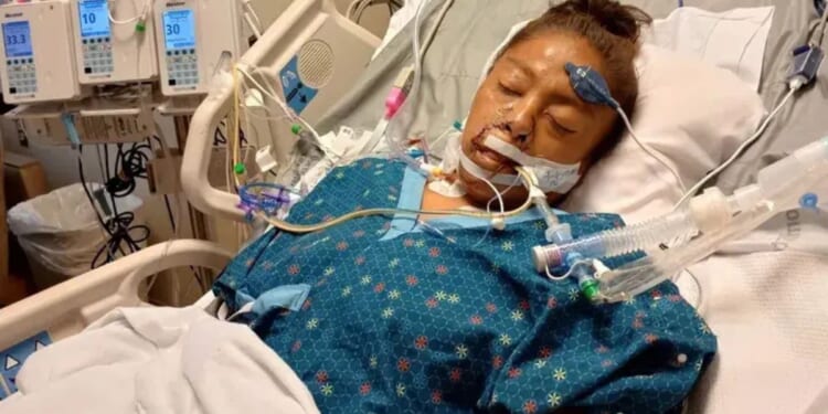 Janelle Scott was attacked by a pitbull and lost all four of her legs on Sept. 9, 2025, in Okmulgee, Oklahoma.