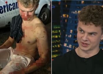 Former DOGE employee Edward "Big Balls" Coristine talked with Fox News about how he was violently assaulted in Washington D.C. in August as he went to the defense of a woman attacked by thugs.