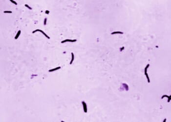 Global tuberculosis diagnoses rise to a record, but deaths fall, WHO reports