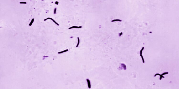 Global tuberculosis diagnoses rise to a record, but deaths fall, WHO reports