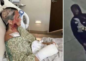 Ashley Wasielewski was attacked with a corrosive substance in Savannah, Georgia, on Dec. 10, 2025.