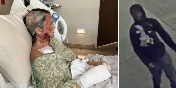 Ashley Wasielewski was attacked with a corrosive substance in Savannah, Georgia, on Dec. 10, 2025.