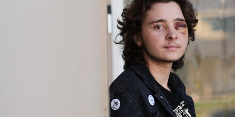 Federal agent fires projectile from close range, injuring demonstrator during California protest