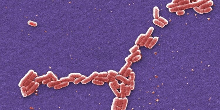 FDA probes multistate E. coli outbreak tied to RAW FARM raw cheddar cheese