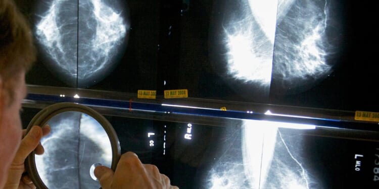 Cost concerns now rival fear of diagnosis as cancer screening barrier, according to survey