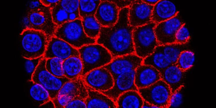 Experimental pill promises new hope for deadly pancreatic cancer