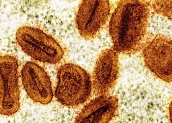 Two foreign nationals working at NIH laboratory charged with smuggling mpox virus into the U.S.