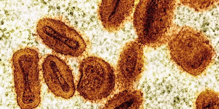 Two foreign nationals working at NIH laboratory charged with smuggling mpox virus into the U.S.