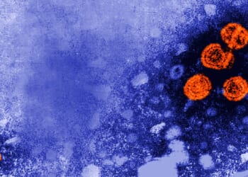 A 1981 microscopic photo of Hepatitis B is pictured.