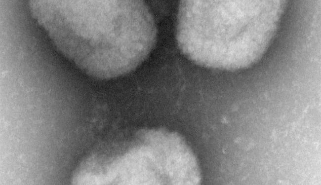 The NIH Went to the Congo and All I Got Was This Lousy Monkeypox – PJ Media