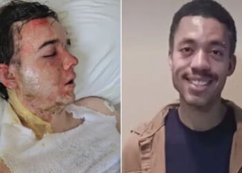 Jacob Smith, 20, left, was hospitalized after a McDonald's coworker, identified as Jalani Bluett, 23, threw hot oil on him at work.