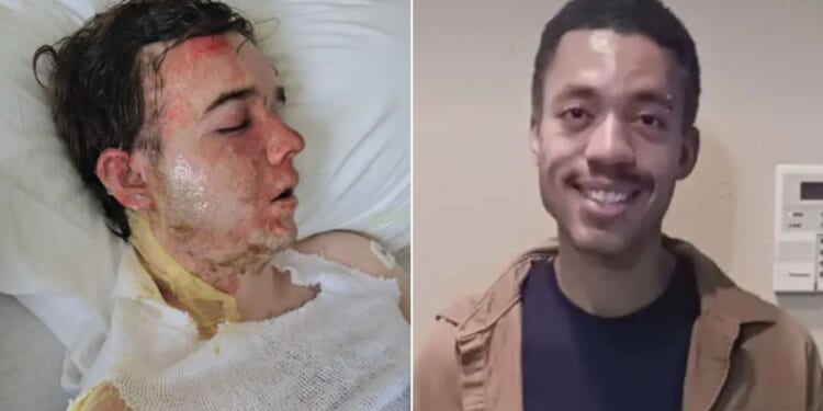 Jacob Smith, 20, left, was hospitalized after a McDonald's coworker, identified as Jalani Bluett, 23, threw hot oil on him at work.