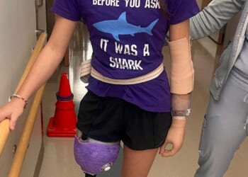 Shark attack on Alabama teen inspires the start of a national alert system