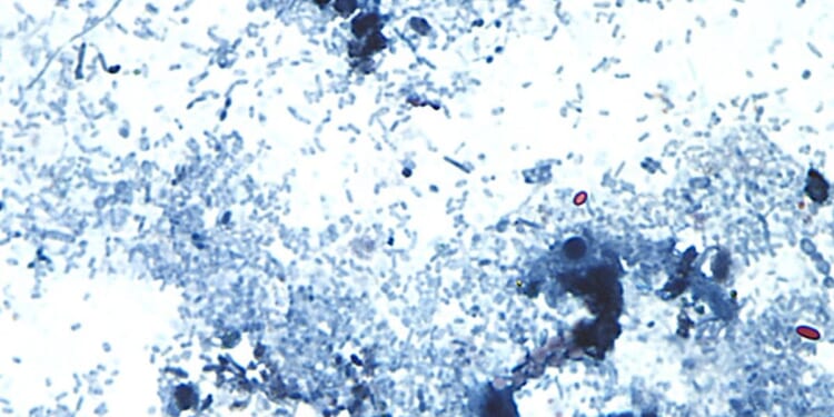 Outbreak of diarrhea-causing parasite grows to more than 1,000 cases