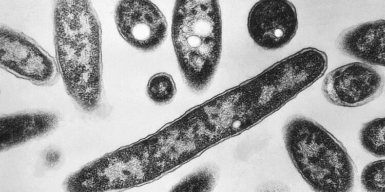 New diagnoses slow in NYC Legionnaires’ disease outbreak; source still unclear