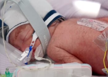 Australian woman gives birth to identical quadruplet girls