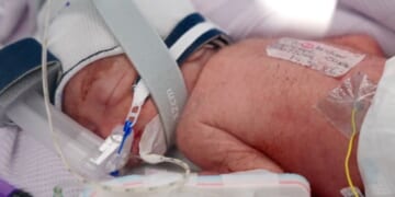 Australian woman gives birth to identical quadruplet girls