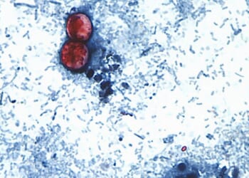 Federal infectious disease surveillance is hampered by split oversight: Report