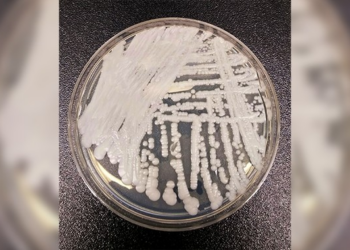 Candida Auris Shows How Dangerous Drug Resistance Can Become – PJ Media