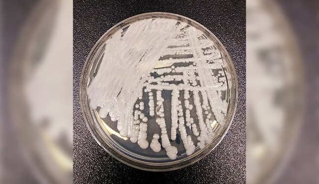 Candida Auris Shows How Dangerous Drug Resistance Can Become – PJ Media