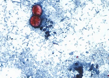 Cyclospora fears force lettuce farmers to plow fields under