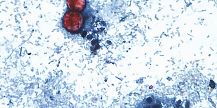 U.S. officials declare an end to record-setting cyclospora outbreak, but its origin is still unknown
