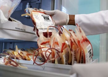 West African scientists warn of weakening health systems and urge stronger outbreak detection